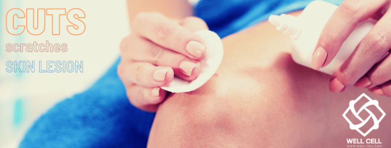 Skin lesions, healing processes
